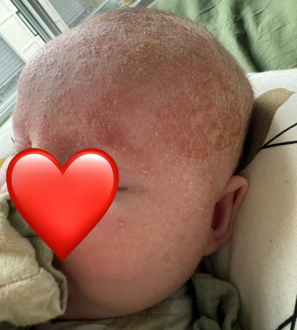 Baby Bundle